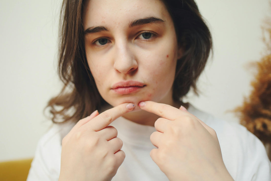 Peau grasse : routine complète pour réguler le sébum sans agresser la peau